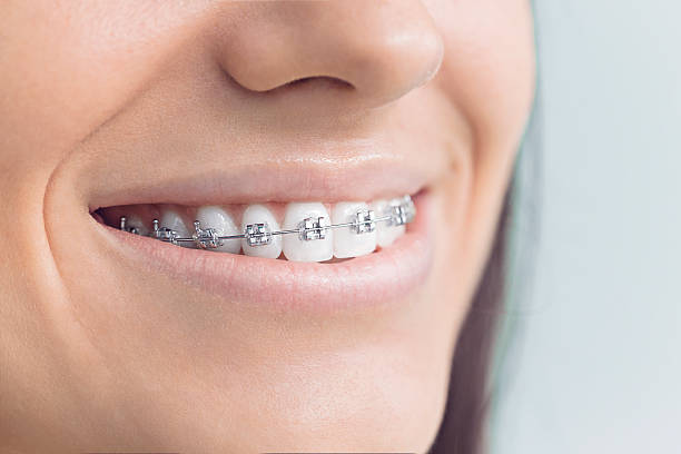 Advanced Technology for Better Dental Care in Marysville, WA